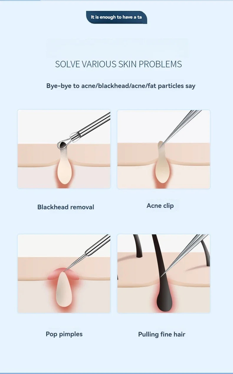 Blackhead & Ingrown Hair Removal Tool Kit (11pcs)