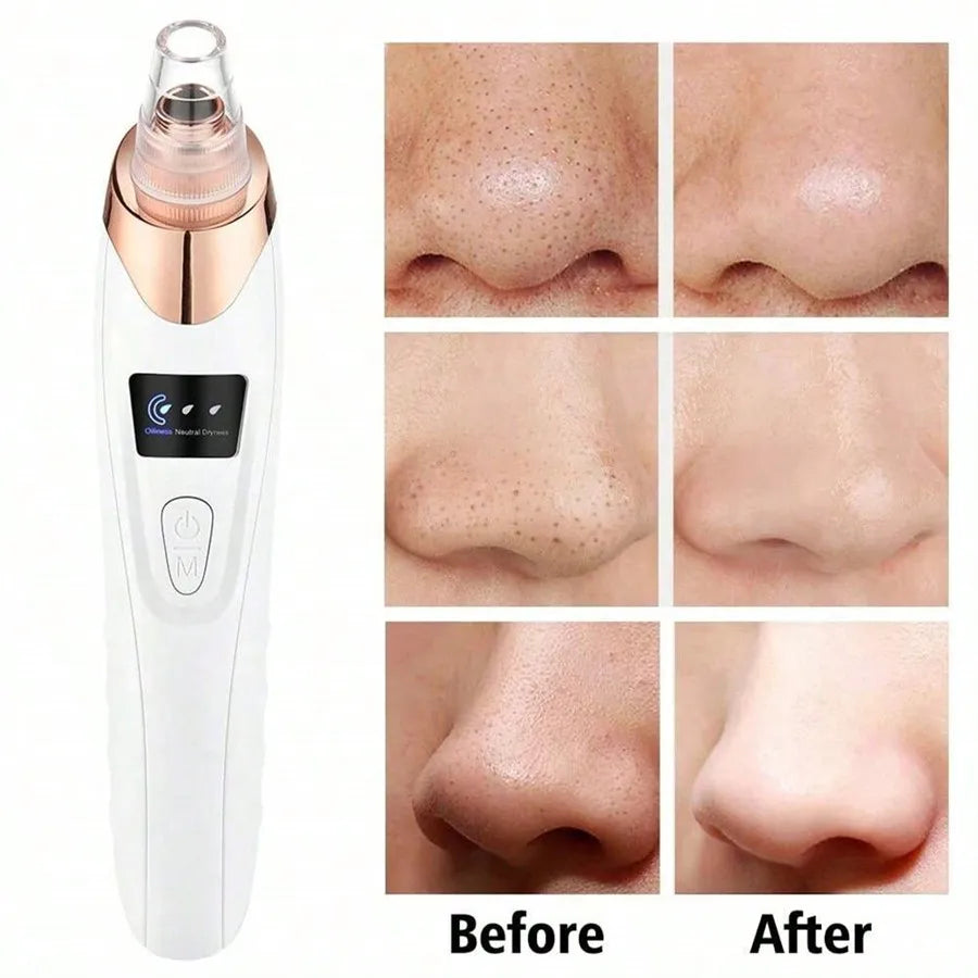 Electric Facial Pore Vacuum