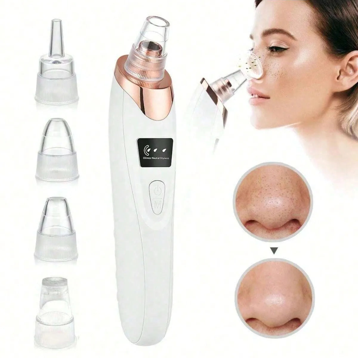 Electric Facial Pore Vacuum