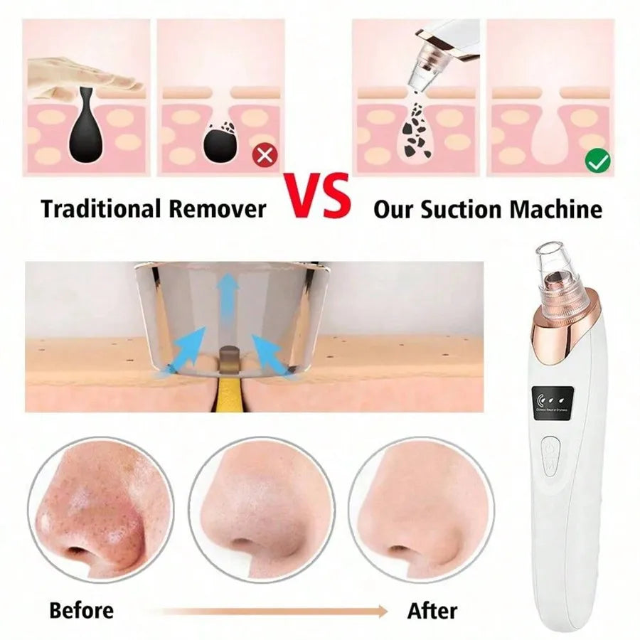 Electric Facial Pore Vacuum
